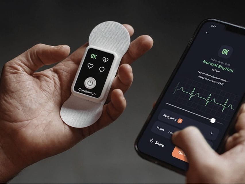 ECG CARDIONICA 