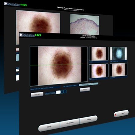 videoDermatoscop SkinDoc + software