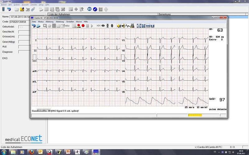 EKG Cardio M-PC