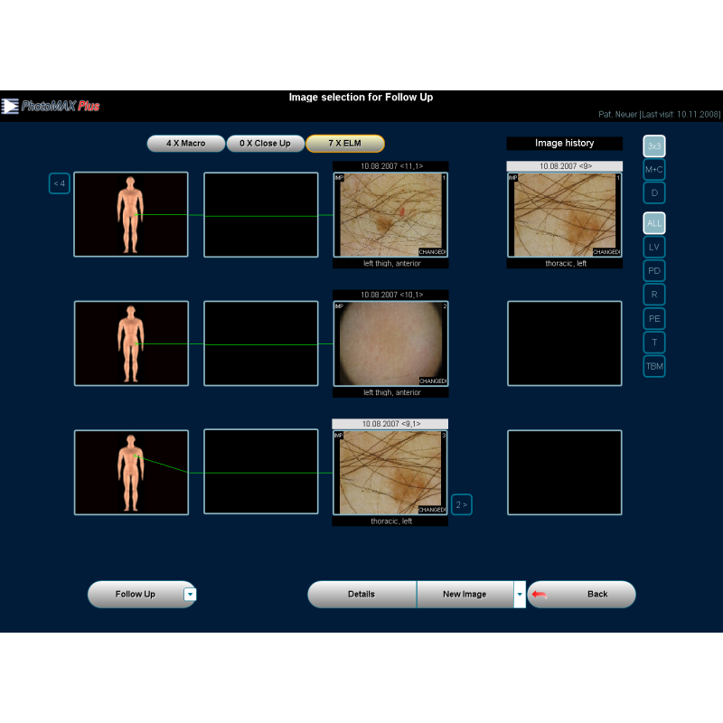 Software dermatoscopie PhotoMAX