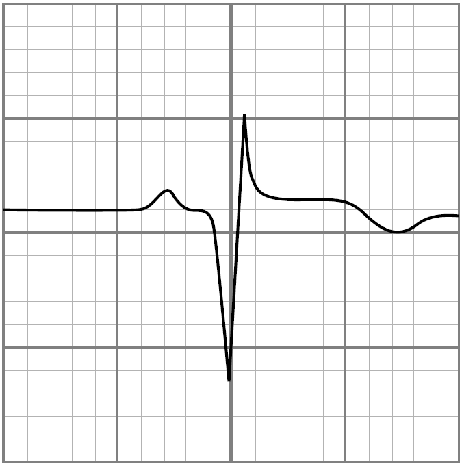 Verificare EKG