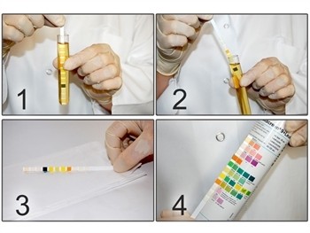 Teste Urina – 10 parametri – tub cu 100 lame