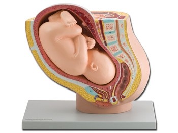Mulaj pelvis cu fetus matur