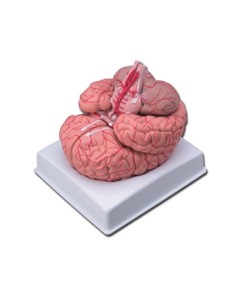 Mulaj creier cu artere