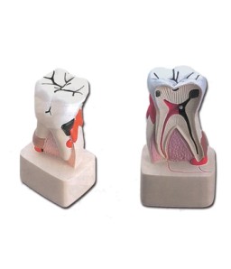 Mulaj patologia dentara