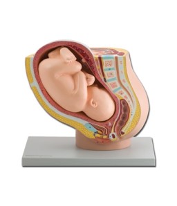 Mulaj pelvis cu fetus matur
