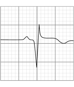 Verificare EKG