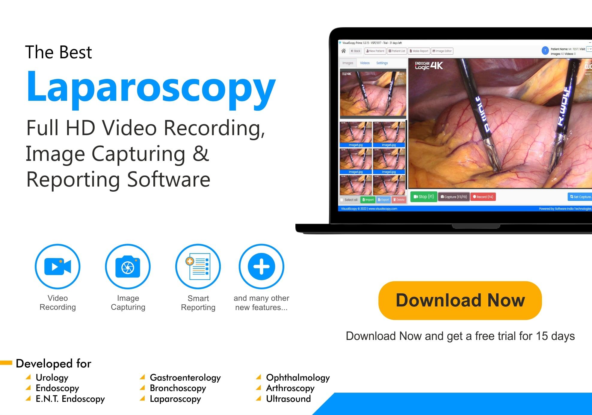 software laparoscopie